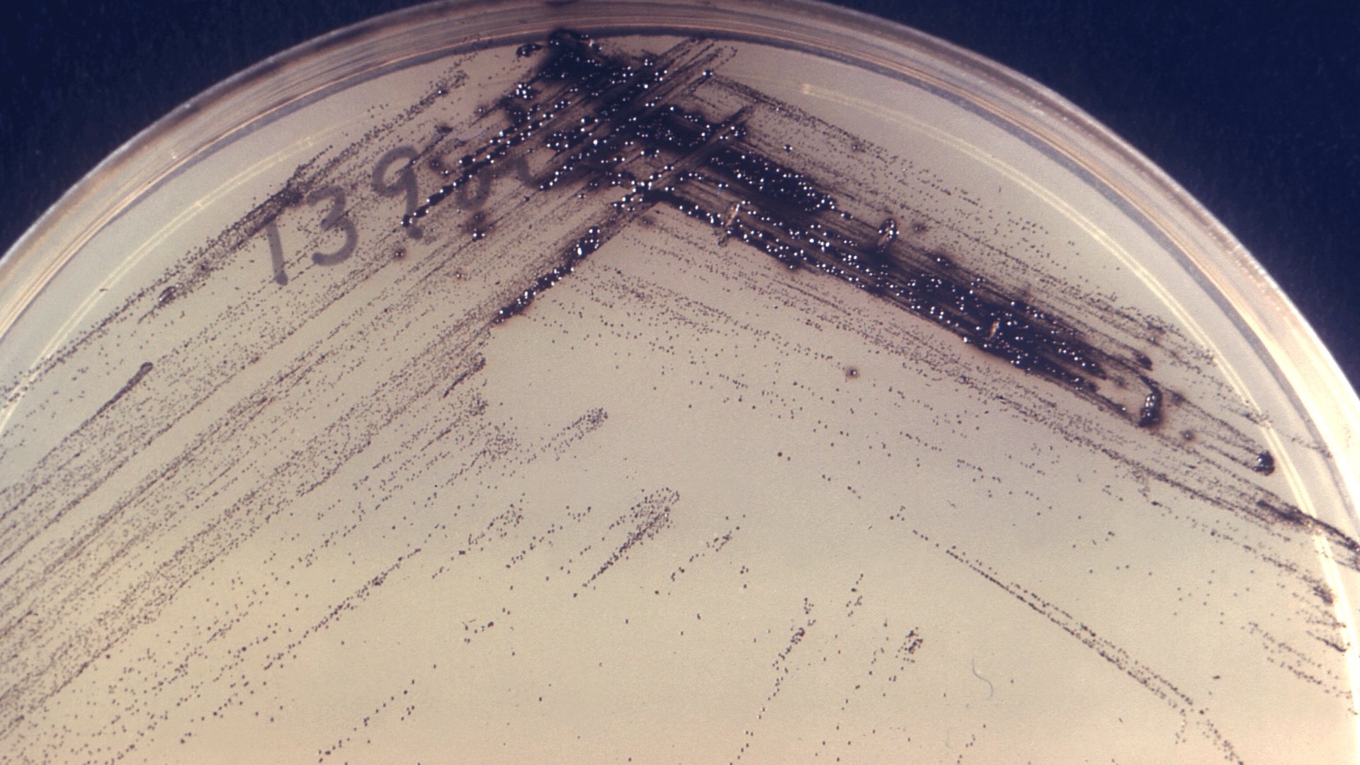 Gut Microbiome and IQ: Can Your Gut Bacteria Make You Smarter?