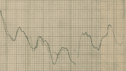 What is aimswebPlus? Pearson's benchmark screening and progress monitoring system